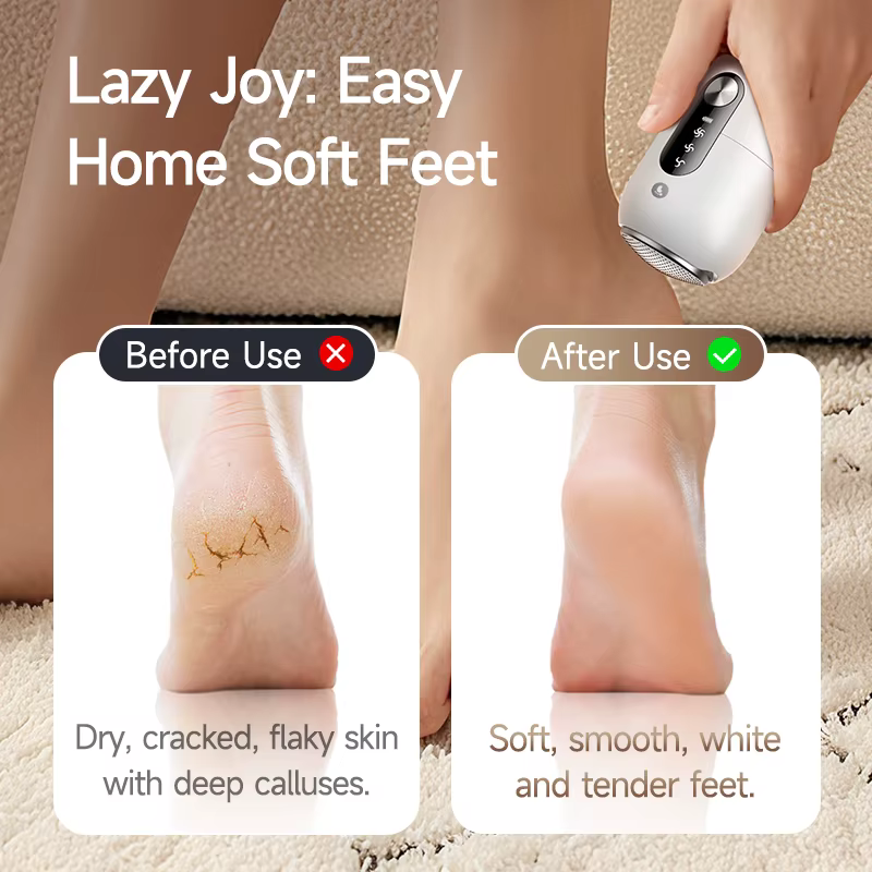 Ponceuse électrique pour les pieds, outil portable de soin des pieds, exfoliant automatique pour les peaux mortes des pieds et des talons, polissage de la peau
