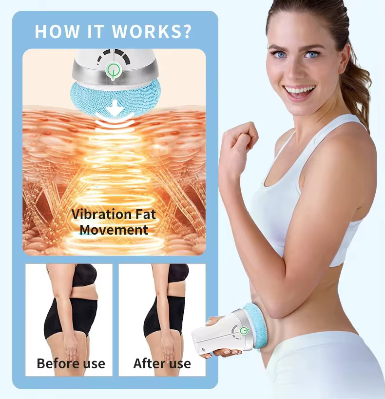 Équipement de Massage de mise en forme du corps, brûleur de graisse multifonction, outil de soins de la forme du corps pour la perte de poids, dispositif de mise en forme amincissant